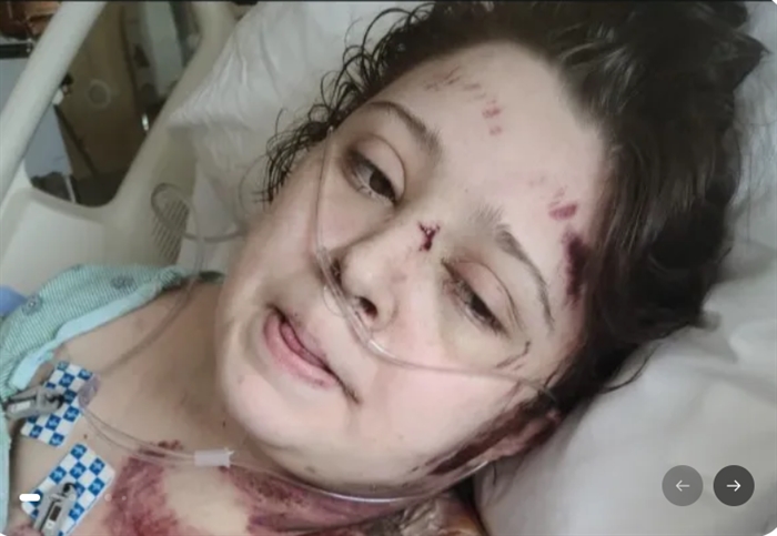 Julie Steed paralyzed in Lafayette DWI scooter crash, police say